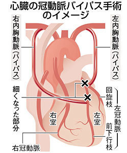 バイパス2.jpg